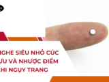 Tai nghe siêu nhỏ cúc áo: Ưu và nhược điểm khi ngụy trang